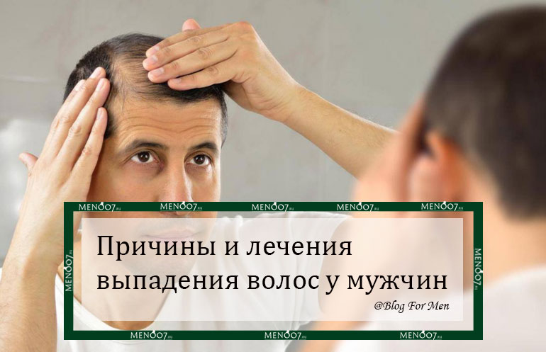 слайд Причины и лечения выпадения волос у мужчин мобильной версии